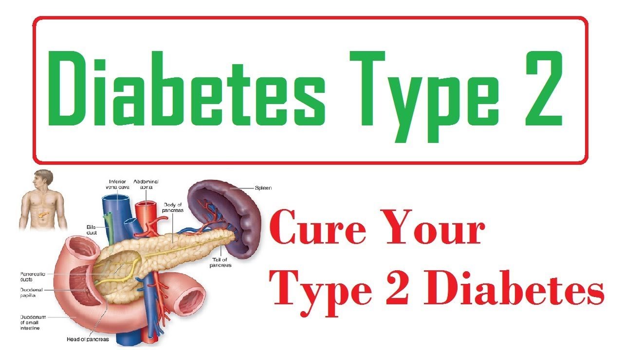 Can Type 2 Diabetes Be Reversed? Understanding Diabetes Remission Through Diet and Lifestyle Changes
